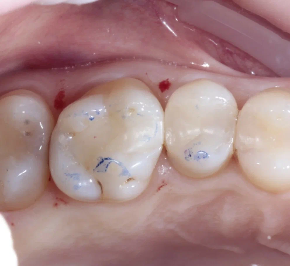 До